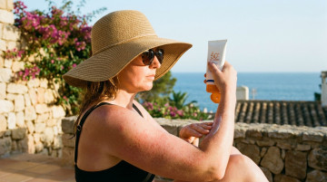 Alergia al sol: cómo identificar los síntomas, tratamiento y mejores cremas protectoras para pieles sensibles
